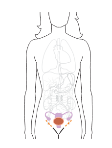 МРТ органов малого таза (женский таз)