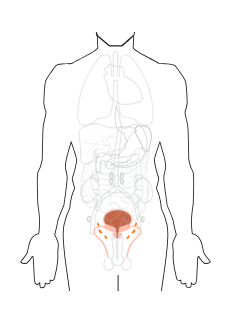 МРТ органов малого таза (мужской таз)