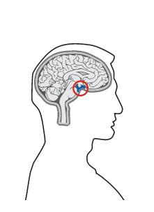 МРТ головного мозга с контрастированием (Турецкое седло)
