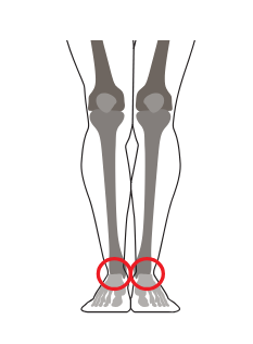 МРТ суставов (голеностопный сустав с одной стороны)
