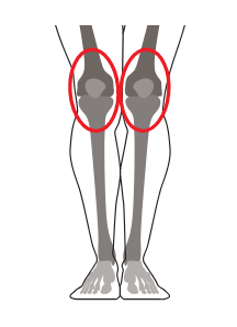 МРТ суставов (коленный сустав с одной стороны)
