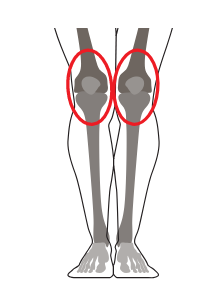 Диагностика причины боли в коленях